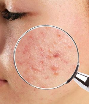 dermatologist